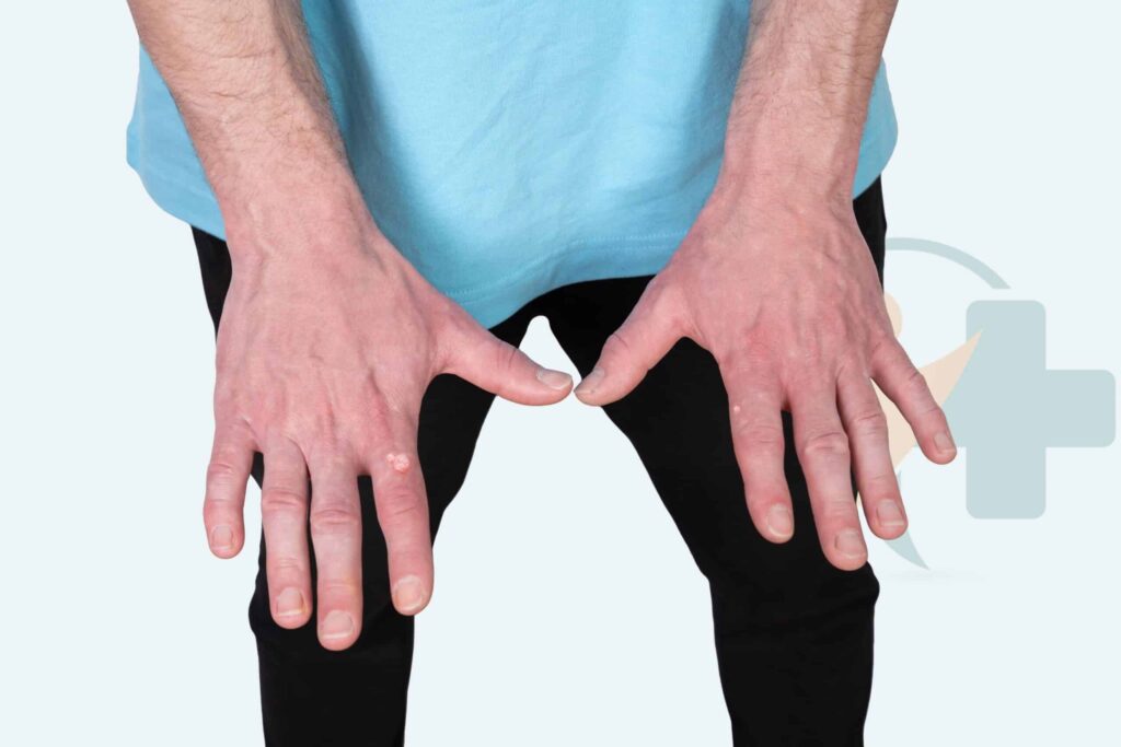 Image for Brody treatment