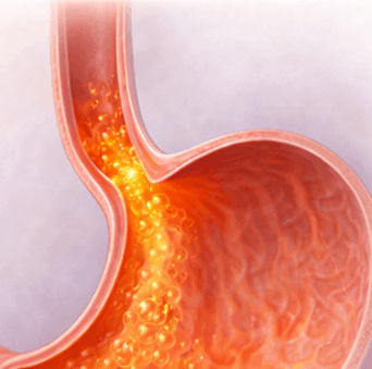Was ist die Hauptfunktion des unteren Ösophagus-Schließmuskels (LES)?