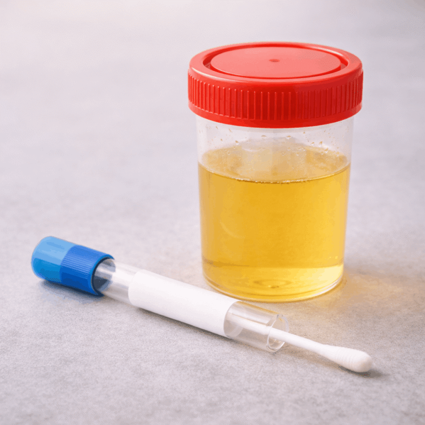 Which testing method is commonly used to diagnose trichomoniasis?