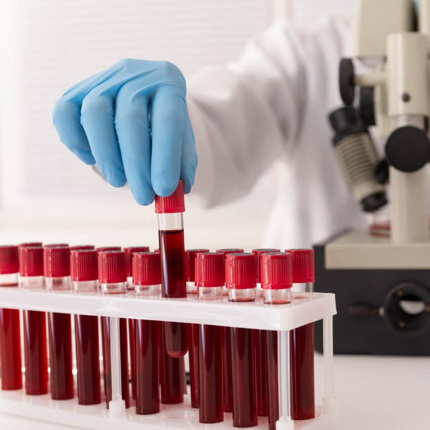 Regular blood tests during masculinizing hormone therapy help ensure safety and effectiveness.