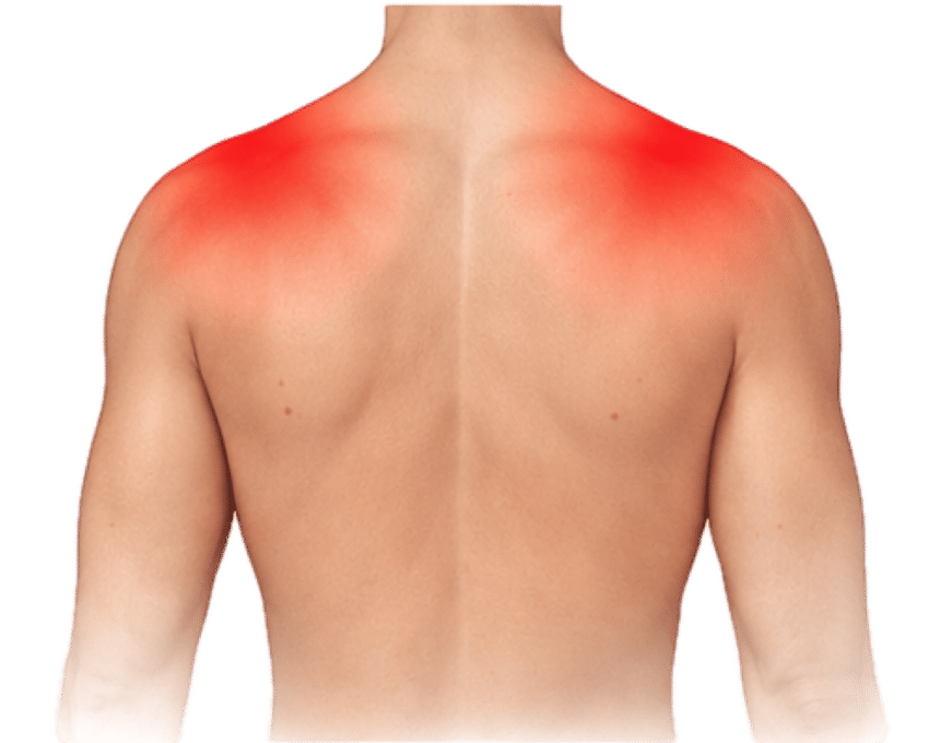 Pain across the shoulders
