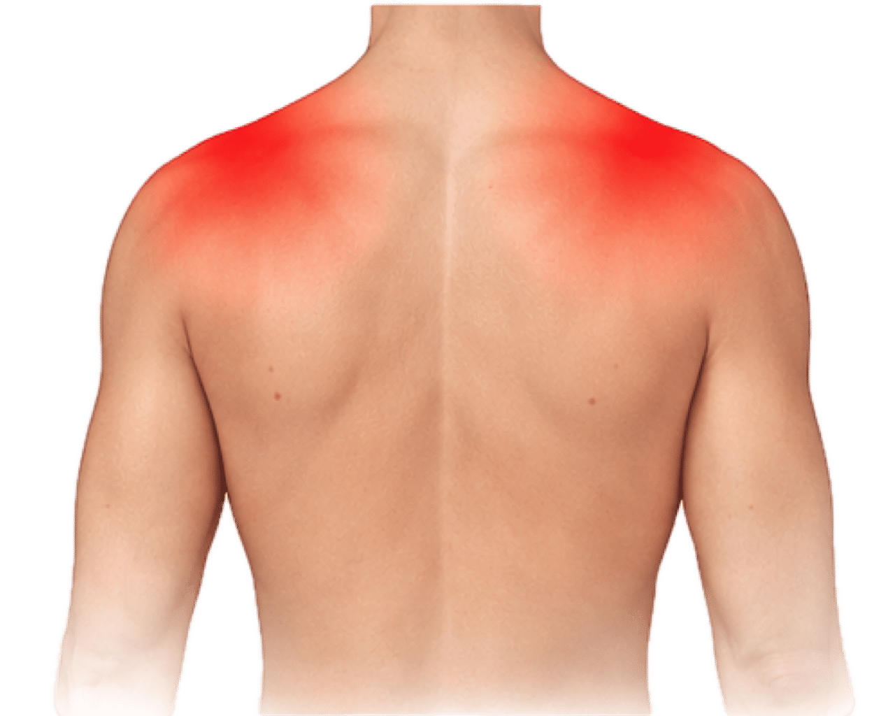 Pijn in de schouders