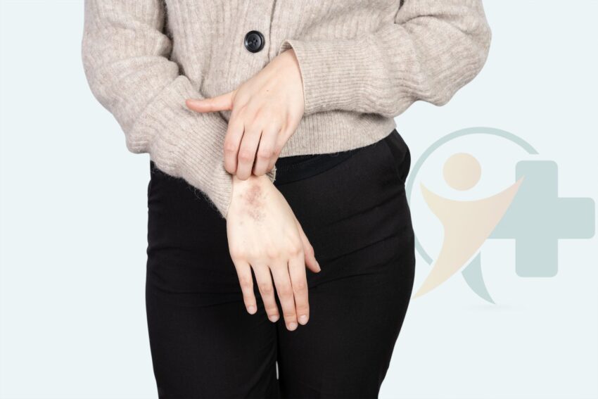 Image for Eczema treatment