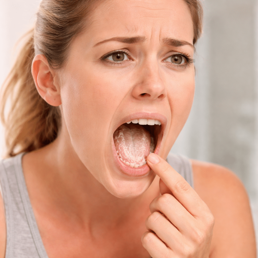 Candida infections only affect women.