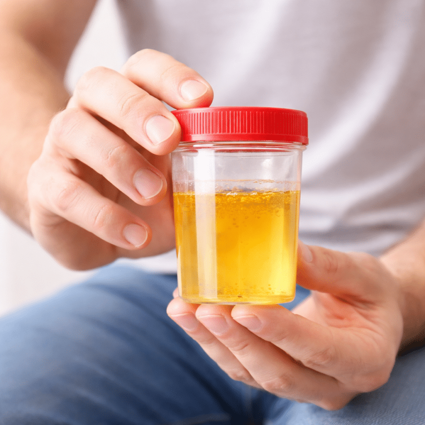 Which habit can help reduce the risk of recurring bladder infections?